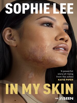 cover image of In My Skin